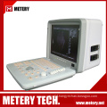 Portable digital ultrasound diagnostic system MT300V